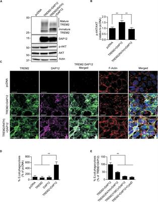 Distinct Signaling Pathways Regulate TREM2 Phagocytic and NFκB Antagonistic Activities